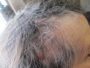 The photos of are of clients of Jeanine Stevenson at Genesis II Hair Replacement Studio in North Syracuse. They show the same client over the course of 10 months.