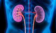 5 Things You Need to Know About Kidney Disease