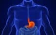 Acid Reflux Common But Treatable