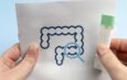 Mail-In Colon Cancer Test Kits Offer Affordable Screening