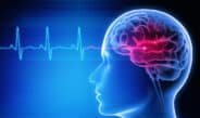 Stroke Recovery Tips