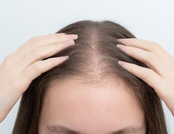 Why Women Lose Hair as They Age